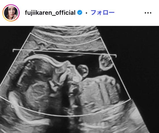 藤井夏恋Instagramより