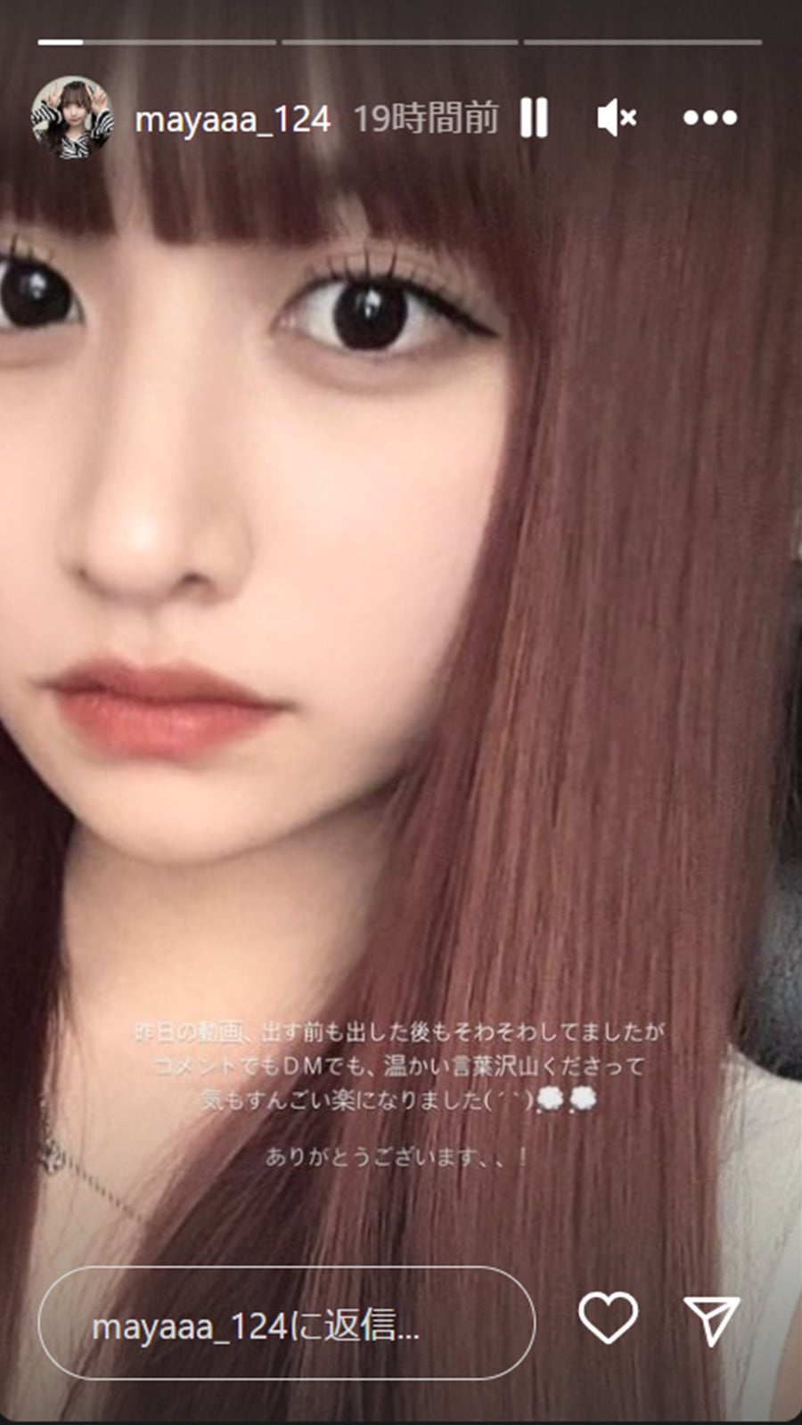 鼻整形後の重川茉弥／重川茉弥Instagramストーリーズより