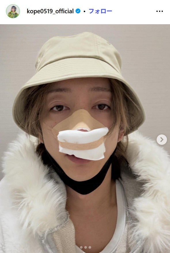 こぺInstagramより