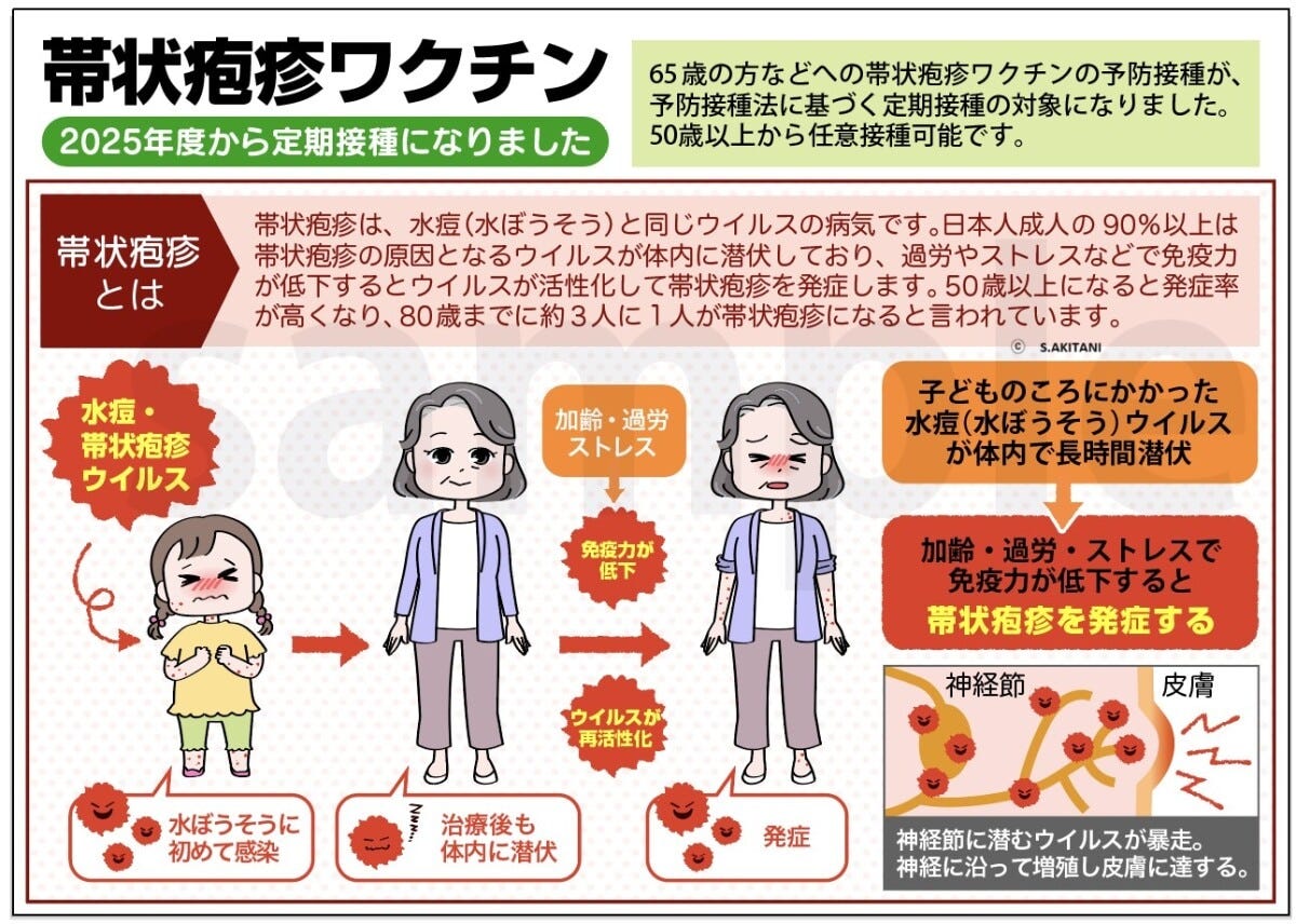 帯状疱疹ワクチンとは?(筆者作成)