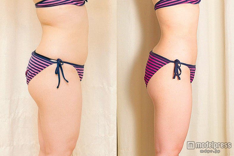 最先端技術で頑固な脂肪とバイバイ!