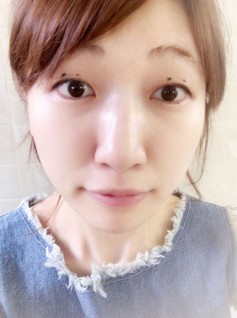 画像5 5 あいのり 桃 整形したての目を公開 モデルプレス