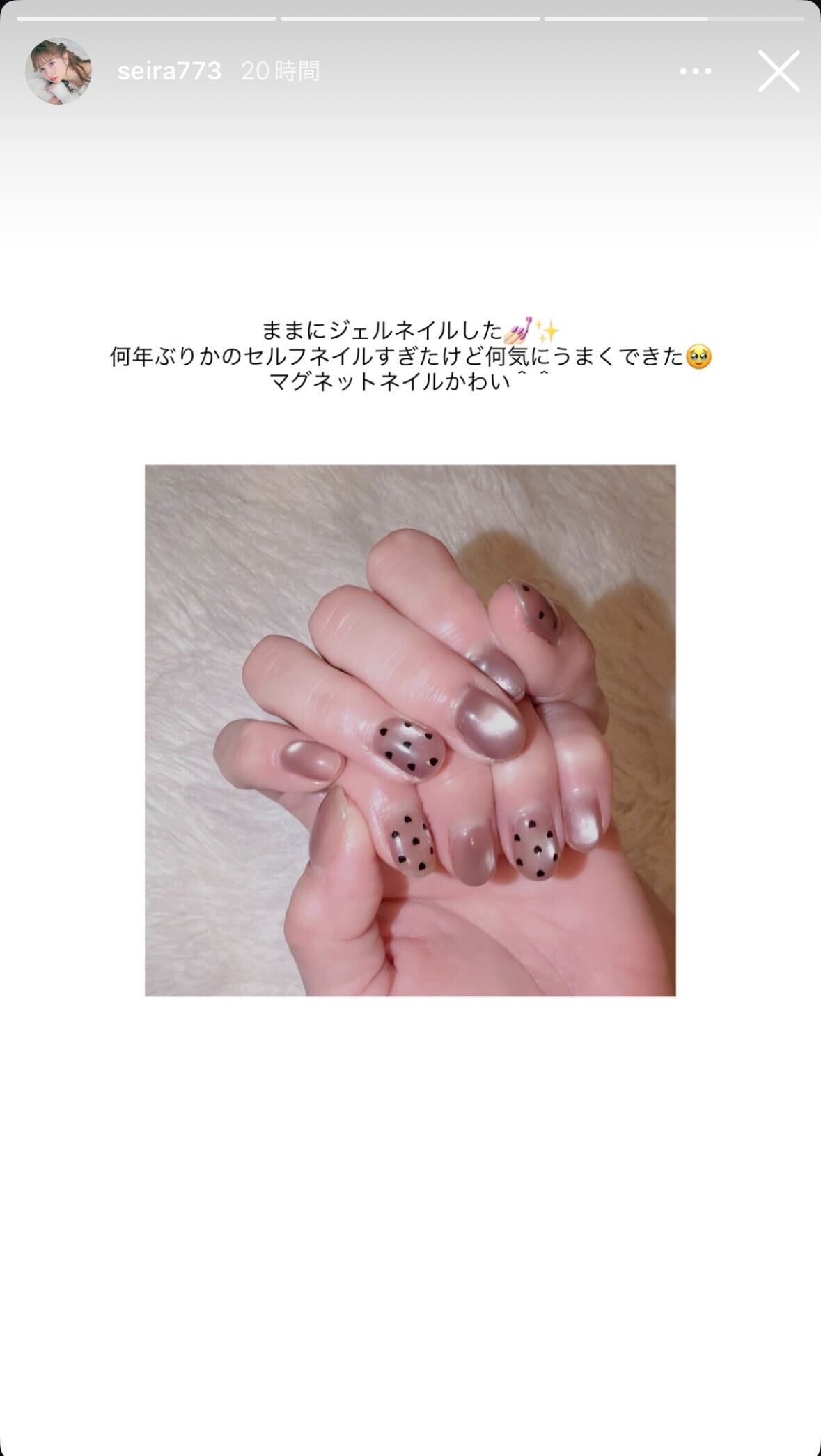 土屋惺来Instagramストーリーズより