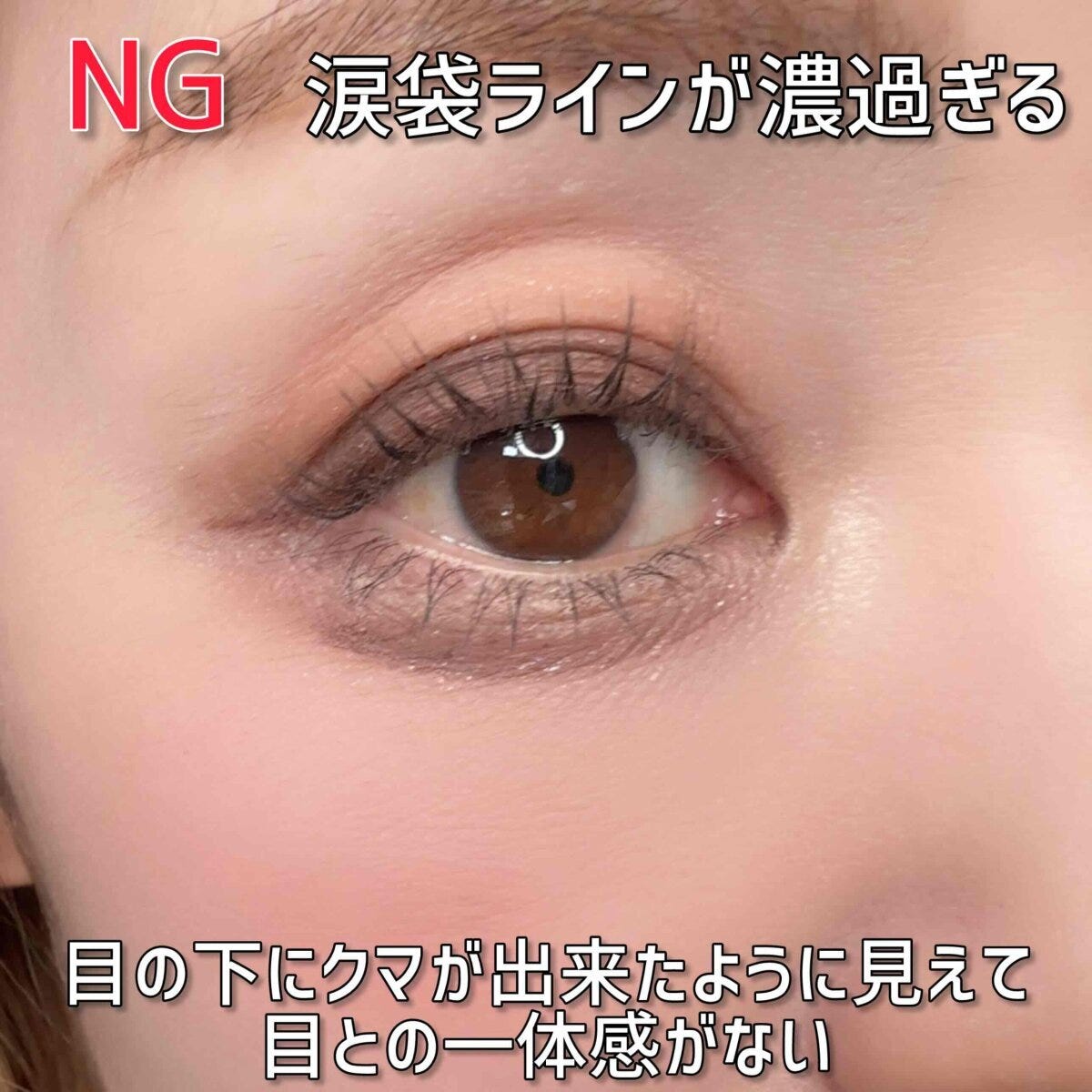 涙袋ラインが濃過ぎて目の下にクマができたように見え一体感がないNG例