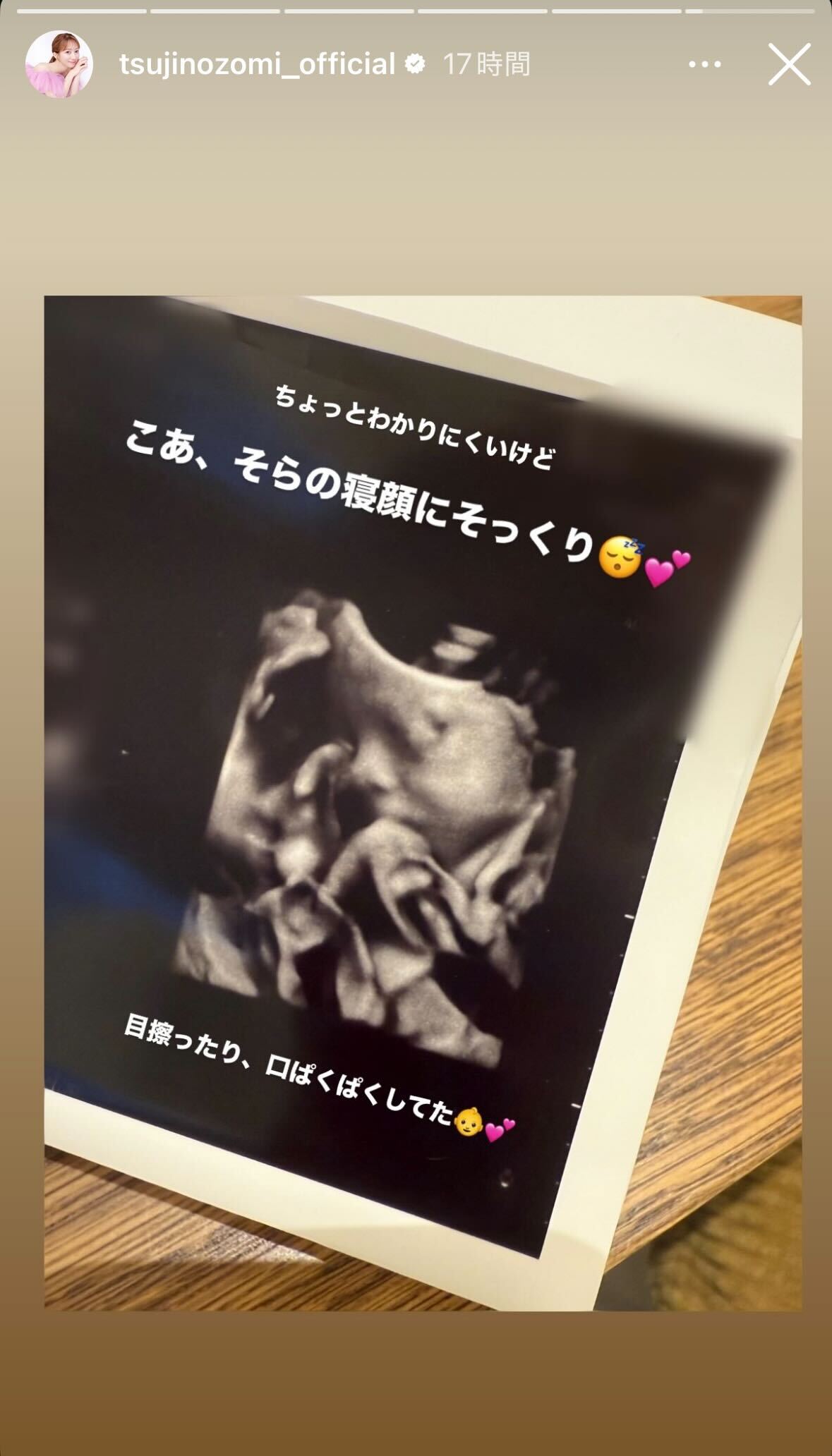 辻希美Instagramストーリーズより