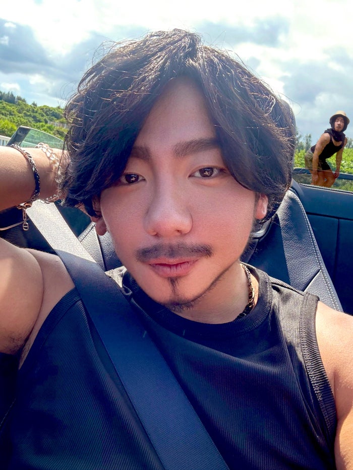 カマたく、人中短縮＆眉下切開整形のビフォーアフター公開「印象ぜんぜん違う」「努力がすごすぎる」の声