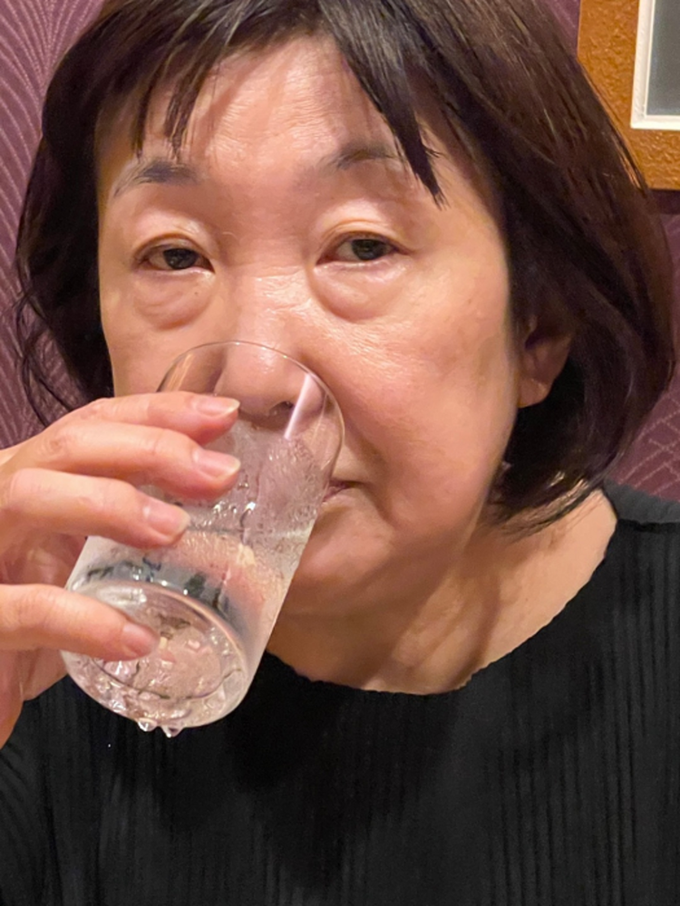 アレク 義母の整形前後の写真を公開 クマひどいなー モデルプレス アレク 義母の整形前後の写真を公開 クマひどいなー モデルプレス