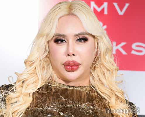 アレン様、整形前の18歳ギャル男時代の写真公開 スタジオ衝撃「モテたでしょ?」