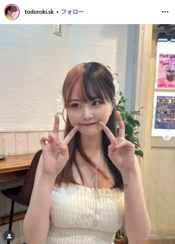 整形アイドル轟ちゃん、整形前後の横顔公開に反響「鼻の変化にびっくり」「努力がすごい」