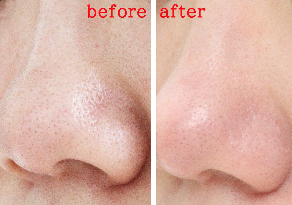 ダイソーの洗顔ブラシのレビュー