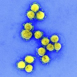 新型コロナ死者34万人超す 世界各地で被害拡大続く