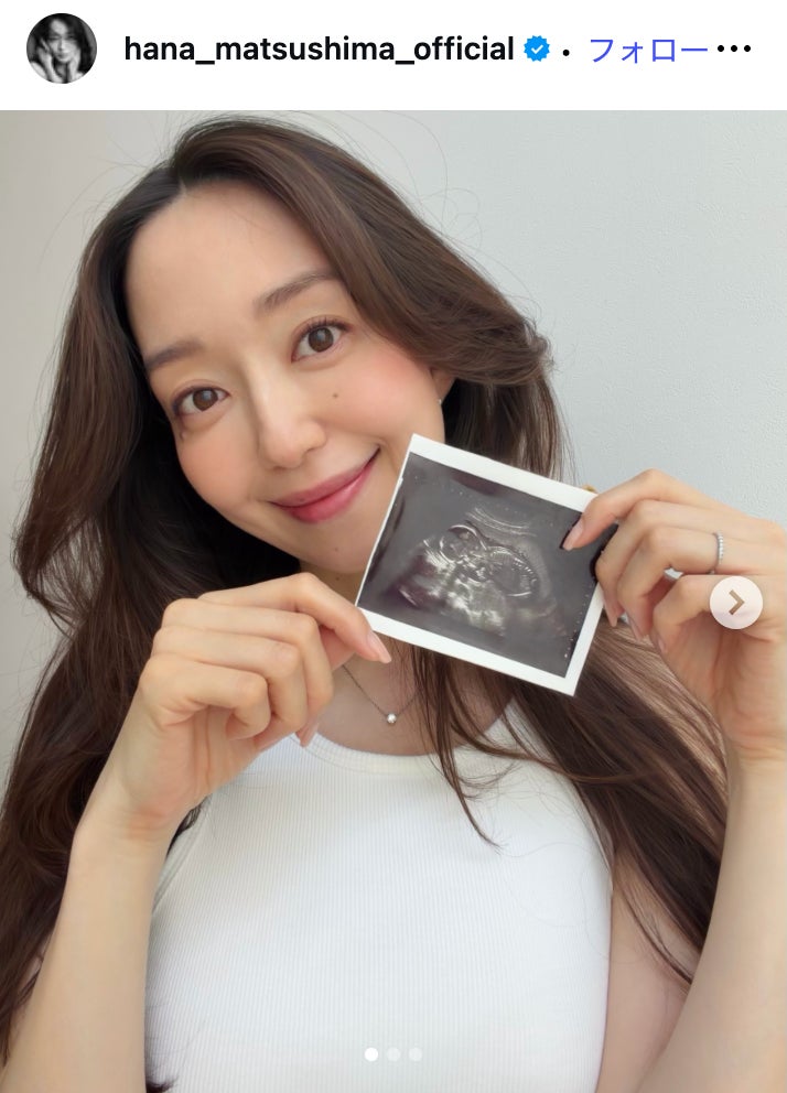 松島花Instagramより