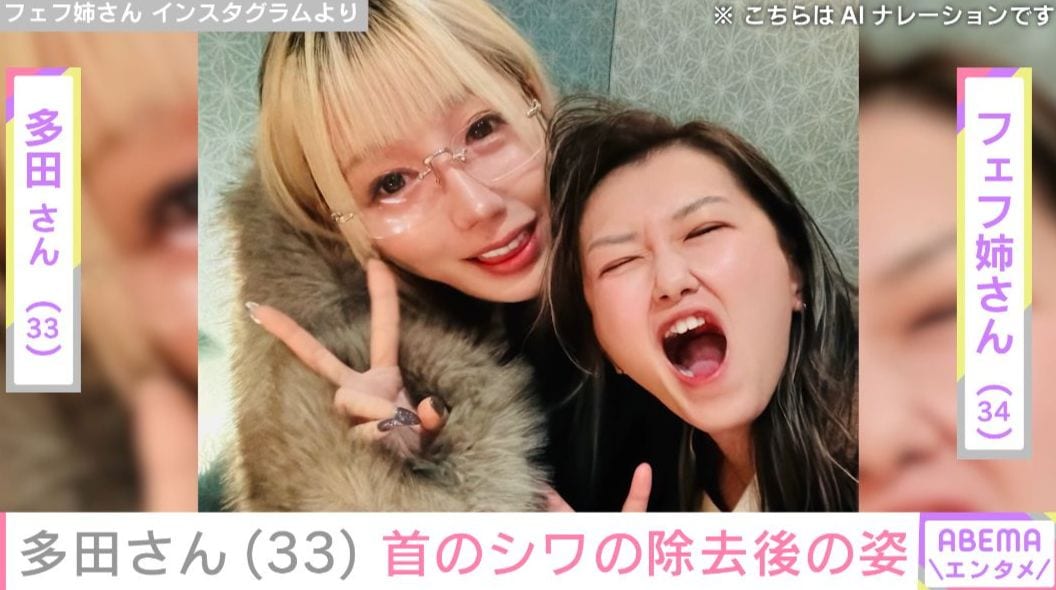 『月曜から夜ふかし』フェフ姉さんの友人・多田さん（33） 首のシワの除去施術後のダウンタイム中の様子を公開