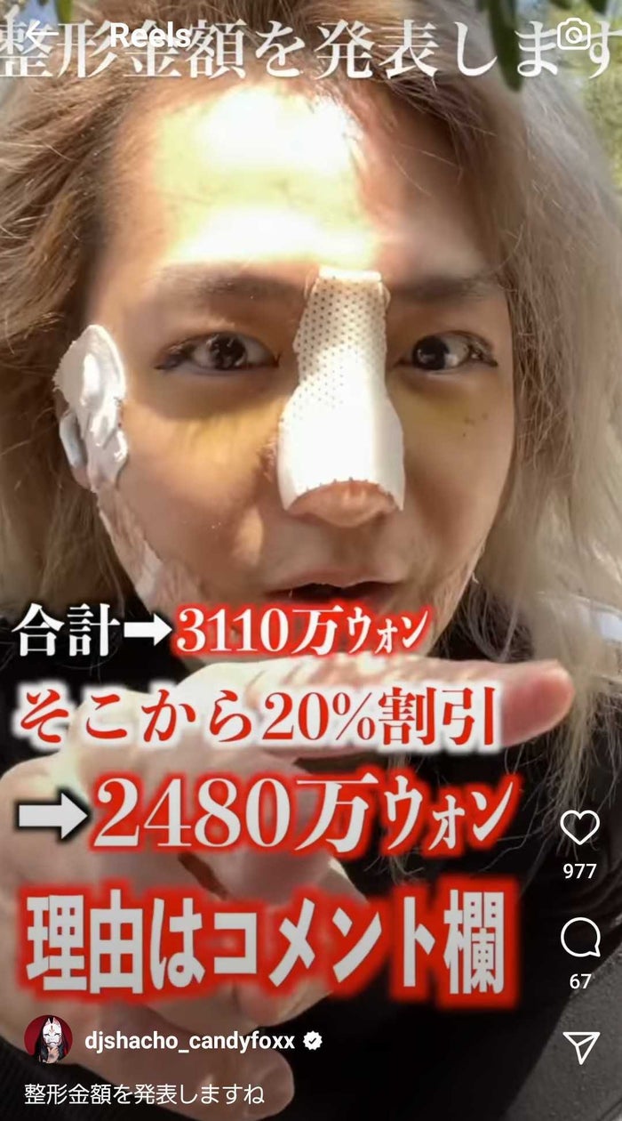 総額250万整形 のdj社長 ダウンタイムの経過報告に反響 面影ありつつイケメン モデルプレス 総額250万整形 のdj社長 ダウンタイムの経過報告に反響 面影ありつつイケメン モデルプレス