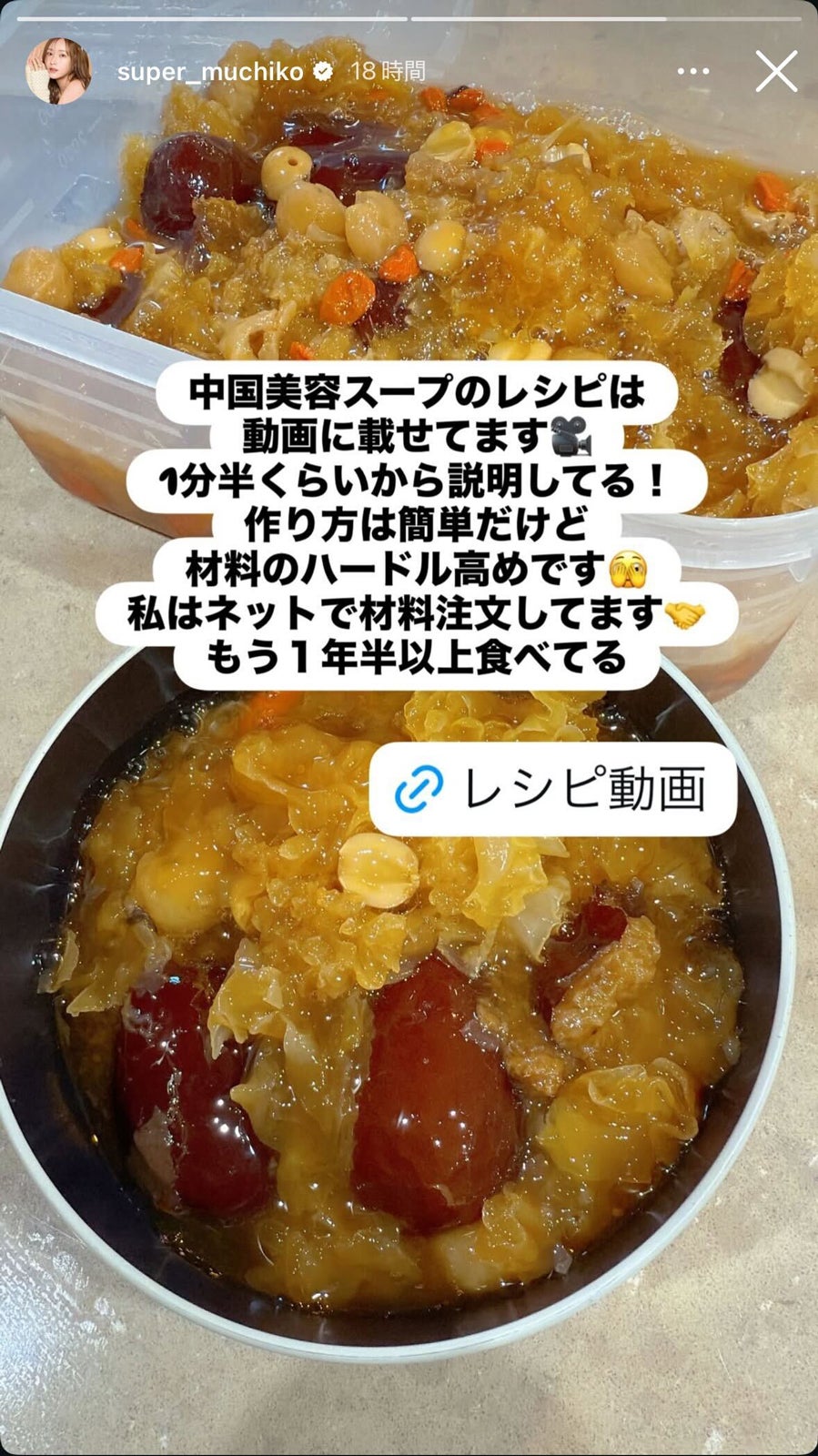 てんちむInstagramストーリーズより