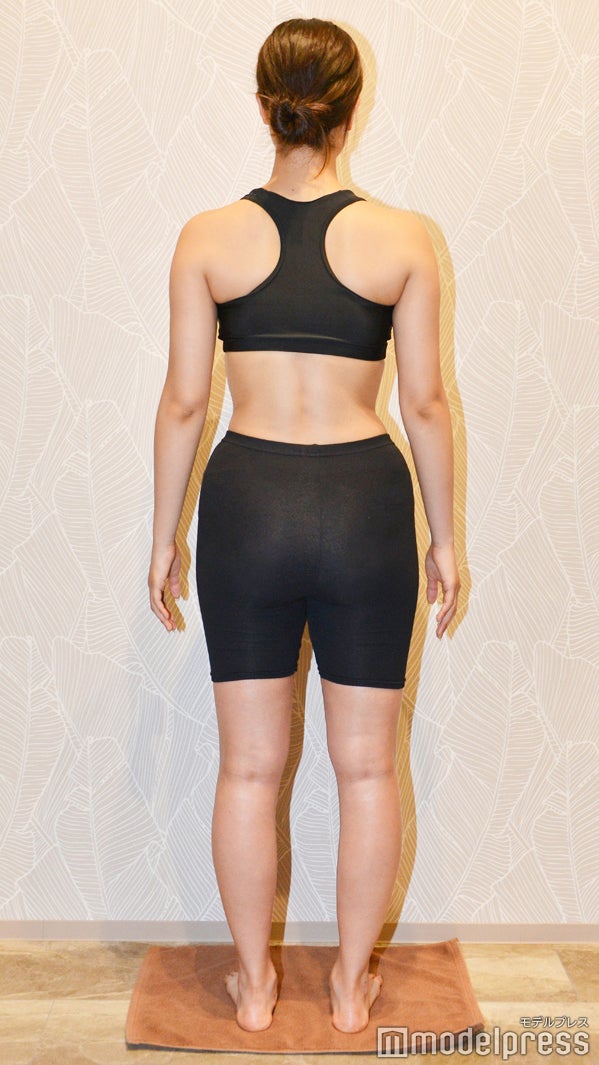 1ヶ月の施術前（C）モデルプレス