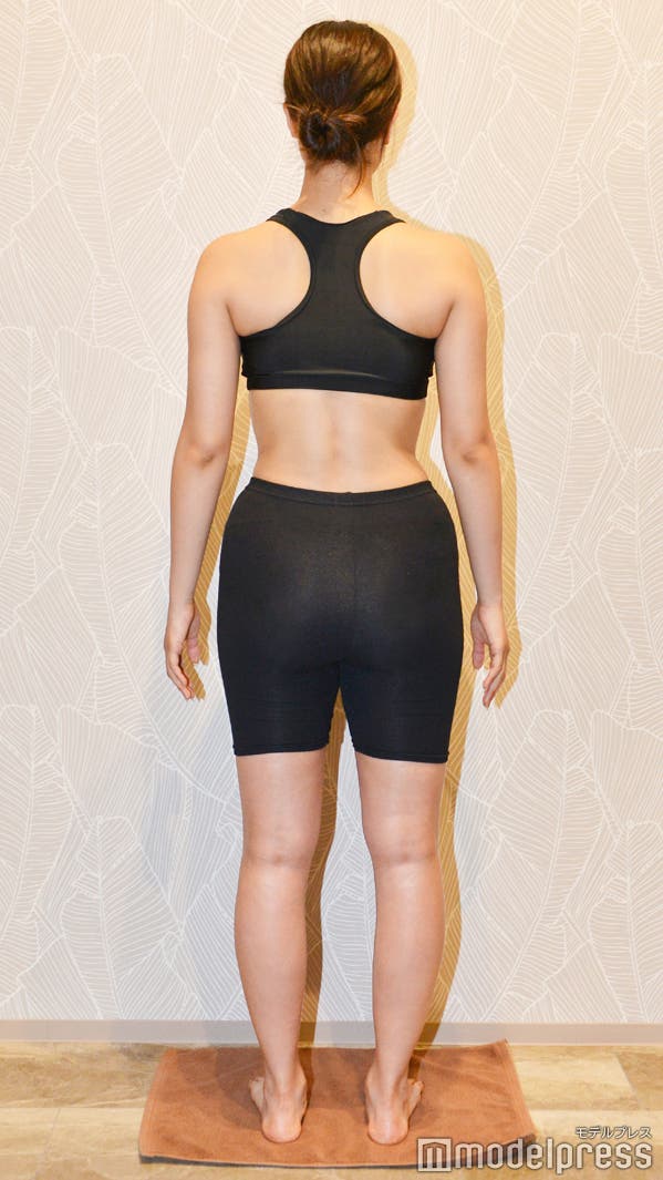 1ヶ月の施術前(C)モデルプレス