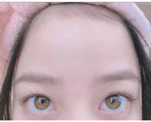 橋本環奈のデコ出し“どアップ”ショットにファン悶絶「破壊力抜群」「産毛すら可愛い」