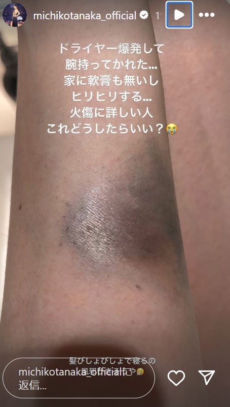 田中道子Instagramストーリーズより