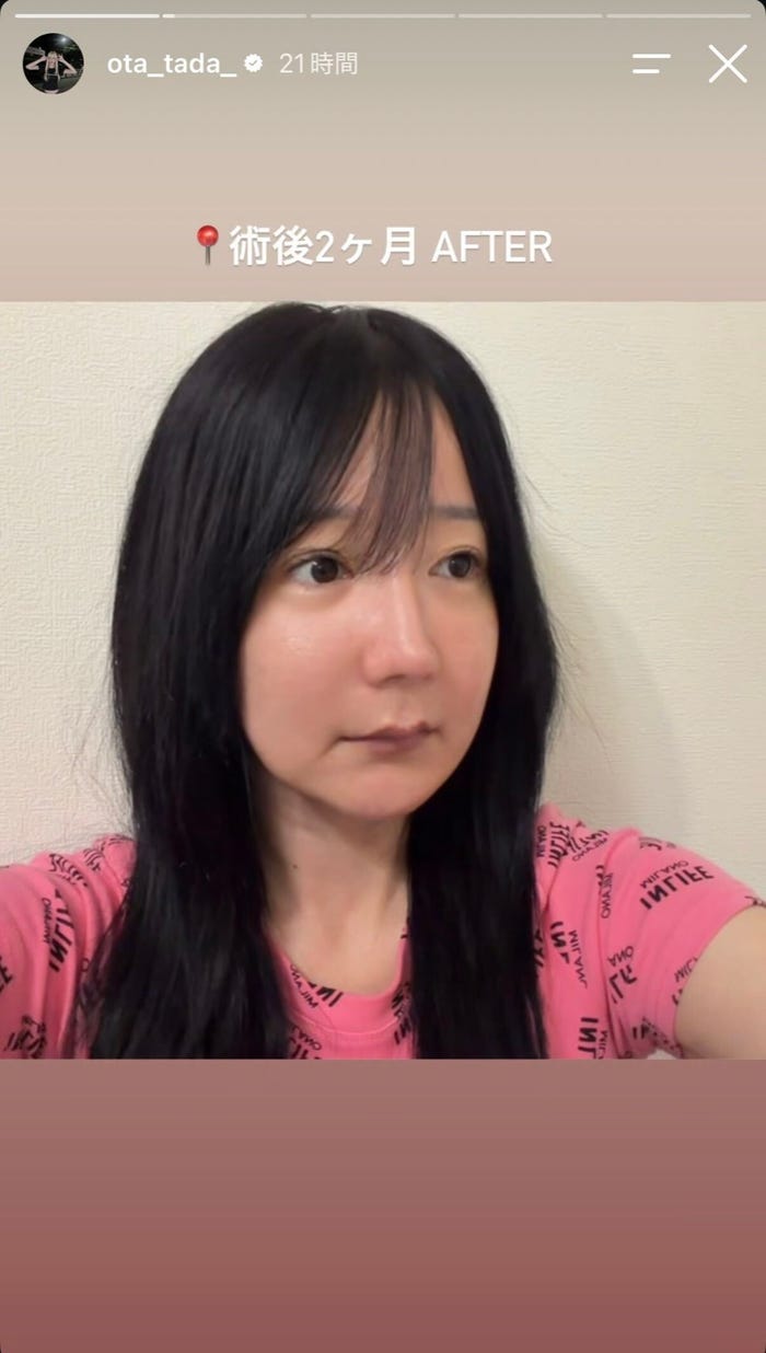 多田さんInstagramストーリーズより