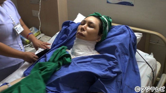 声帯手術を受けるKABA.ちゃん (C)フジテレビ