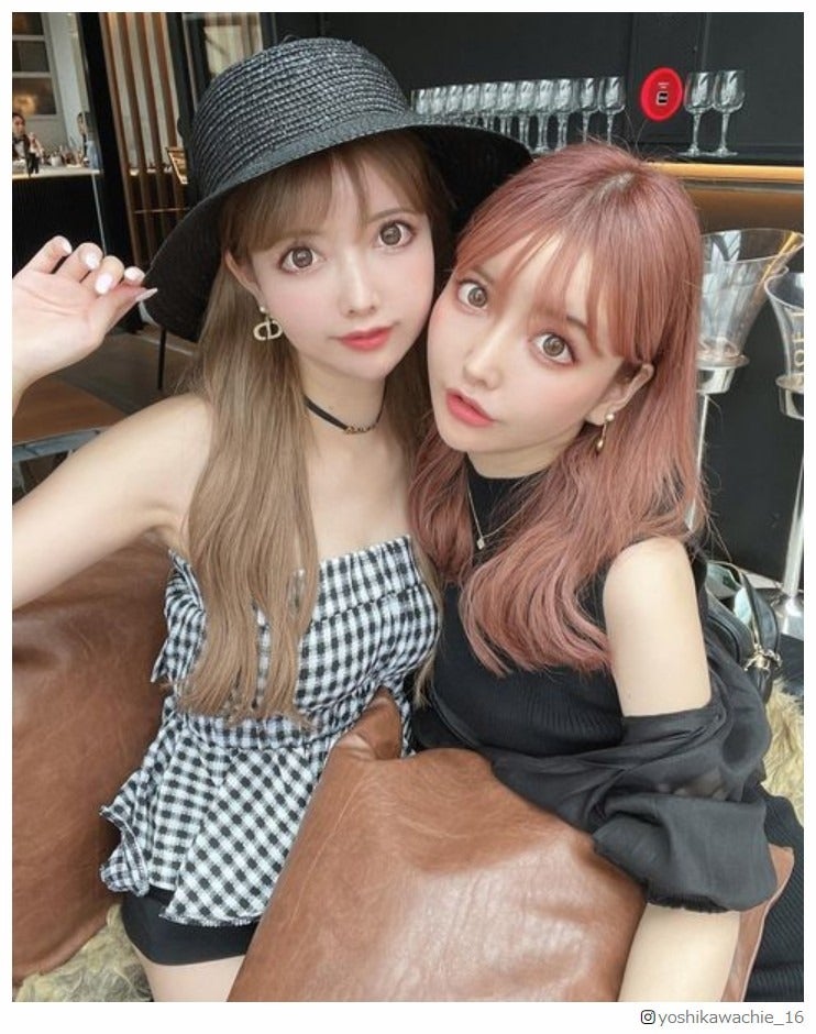 双子モデル・吉川ちえ＆ちか、2人で“総額4000万円超え”整形へのこだわり明かす