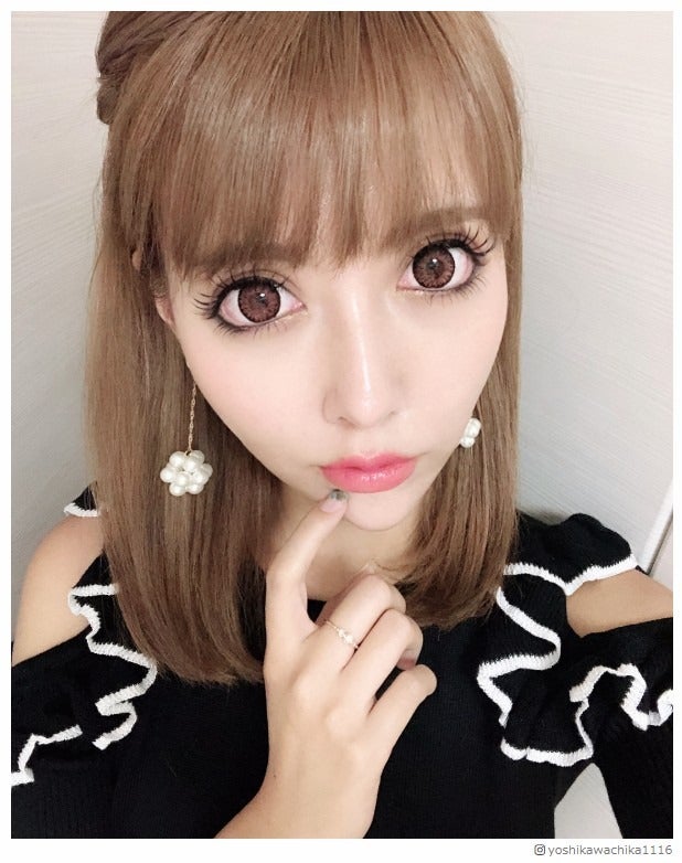 双子モデルの妹・ 吉川ちか、人生最大の整形手術終える 痛々しい術後姿公開