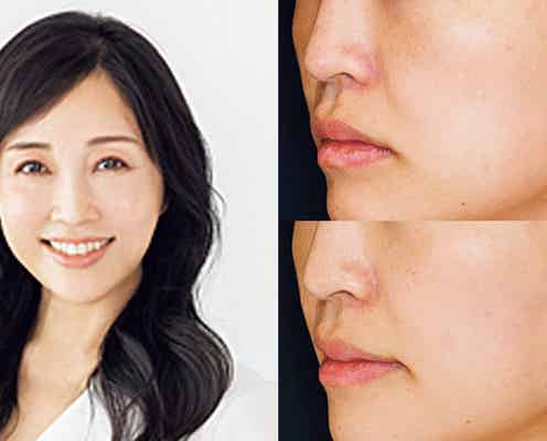 知識がないと取り返しのつかないことに...!話題の美容医療との「正しいつきあい方」とは?