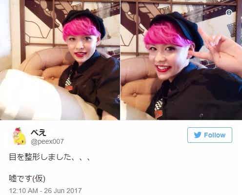 ぺえ、整形を告白?くっきり二重に「イケメン」「かっこいい」の声