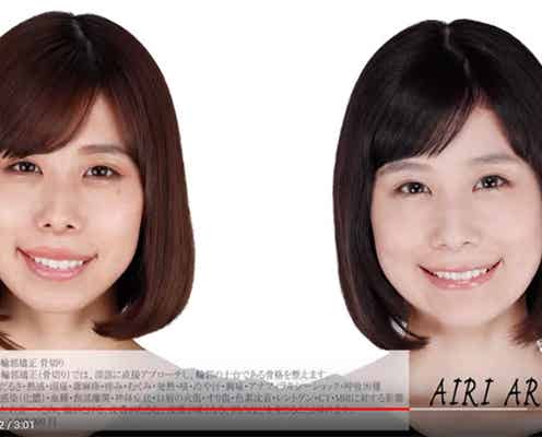 整形公表の有村藍里、施術金額は?ビフォー・アフターを動画で公開