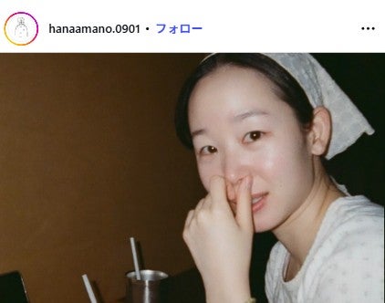「ダウンタイム」天野はな「beforeもafterも特殊メイクです」整形役秘話投稿に反響「本物の整形かと思った」「リアルすぎる」の声