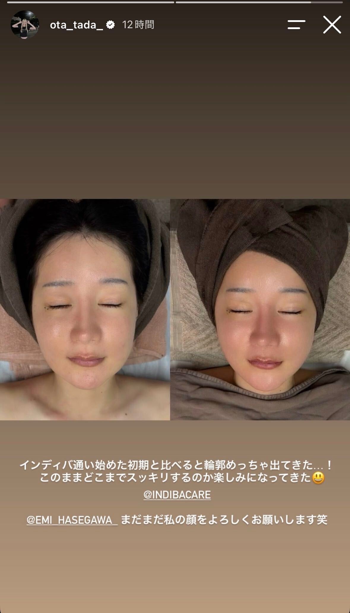 多田さんInstagramストーリーズより