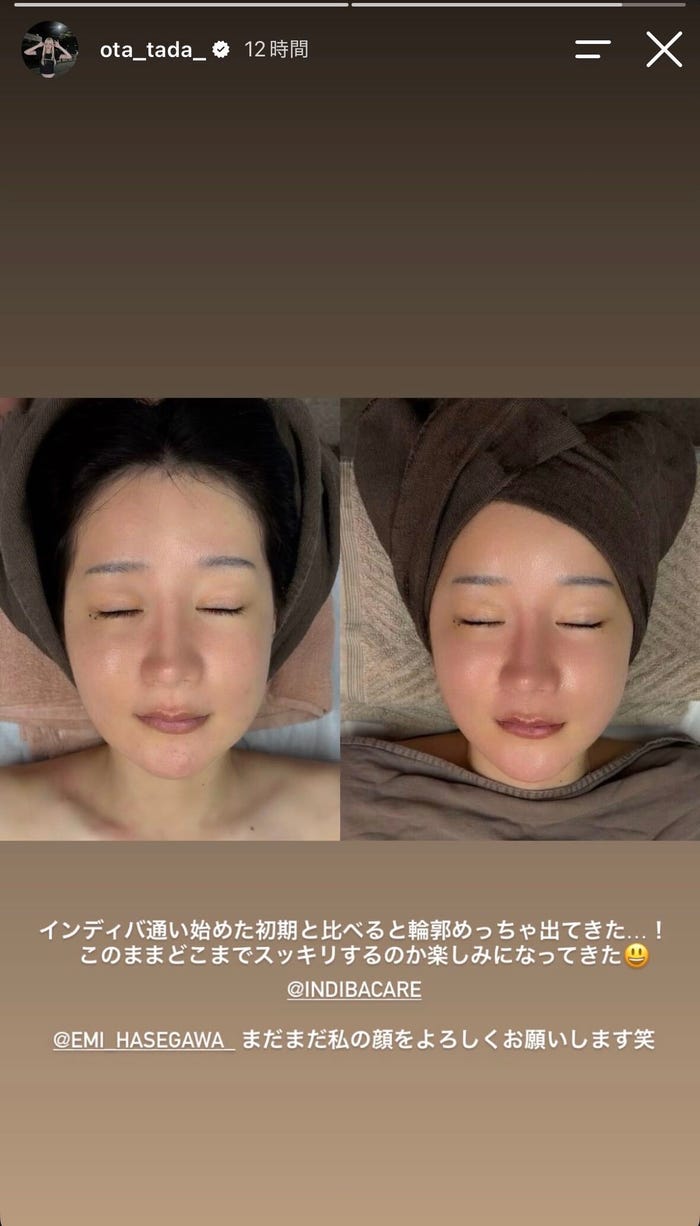 多田さんInstagramストーリーズより