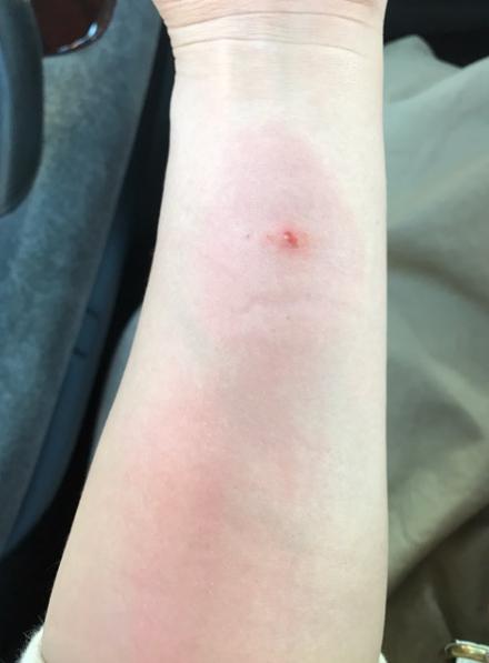 キンタロー。オフィシャルブログ（Ameba）より