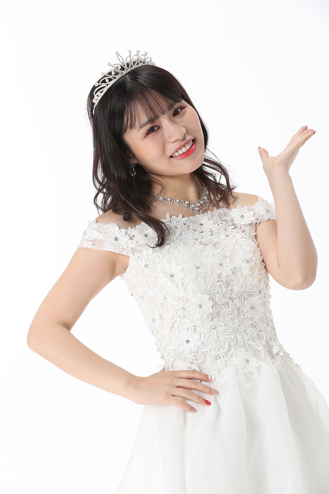 尾上七海さん／整形後 （提供写真）