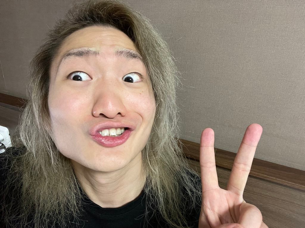 DJ社長、“総額250万”整形手術報告 術後の経過公開