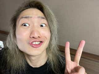 DJ社長、“総額250万”整形手術報告 術後の経過公開