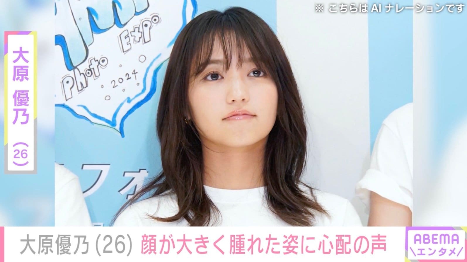 大原優乃（26）、顔が大きく腫れた姿に心配の声「大丈夫ですか？」「かなり痛そう」