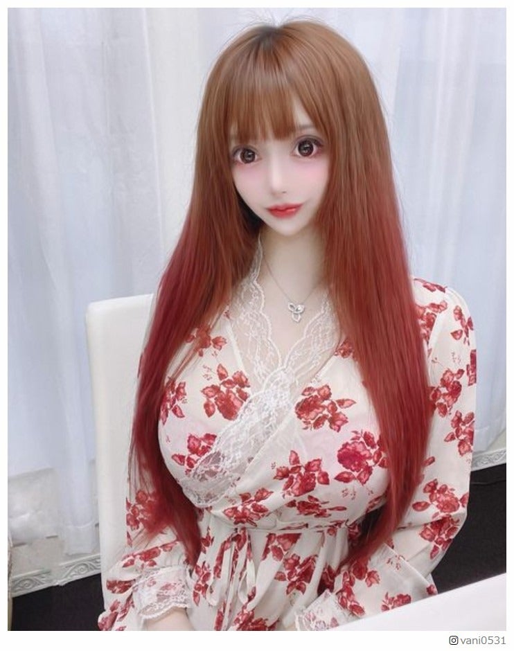 “整形総額3億円”ヴァニラ、3回の豊胸手術について明かす 術後の苦労も告白