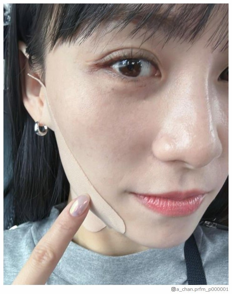 Perfume・あ～ちゃん、初スペインで顔面腫れる 写真公開で心配の声