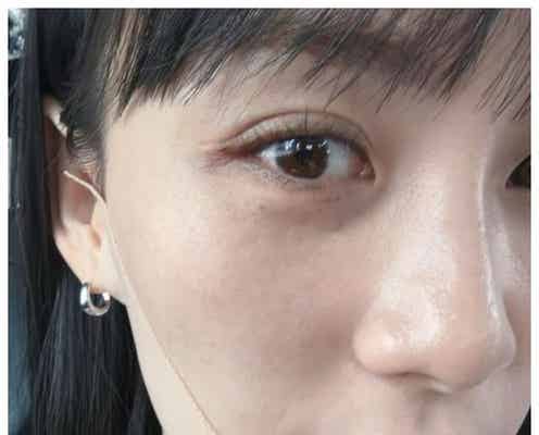 Perfume・あ~ちゃん、初スペインで顔面腫れる 写真公開で心配の声