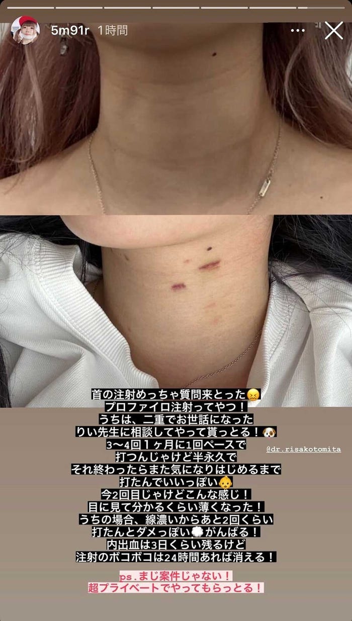 まあたそ公式Instagramストーリーズより