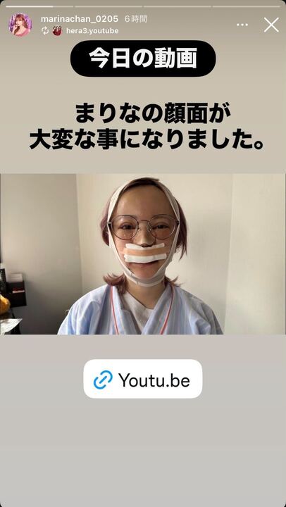 まりなInstagramストーリーズより