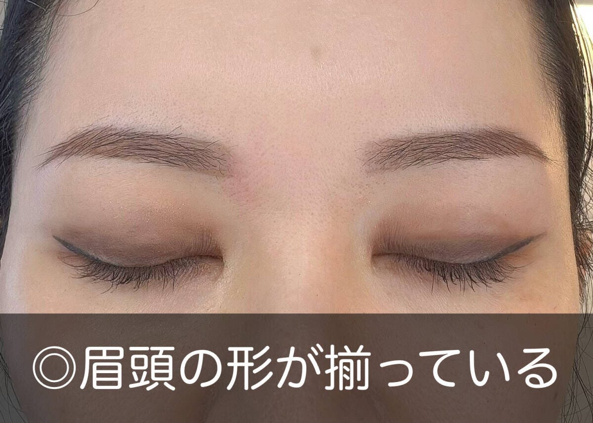 眉頭の下ラインと丸みを左右そろえて形を整えたアフターの眉