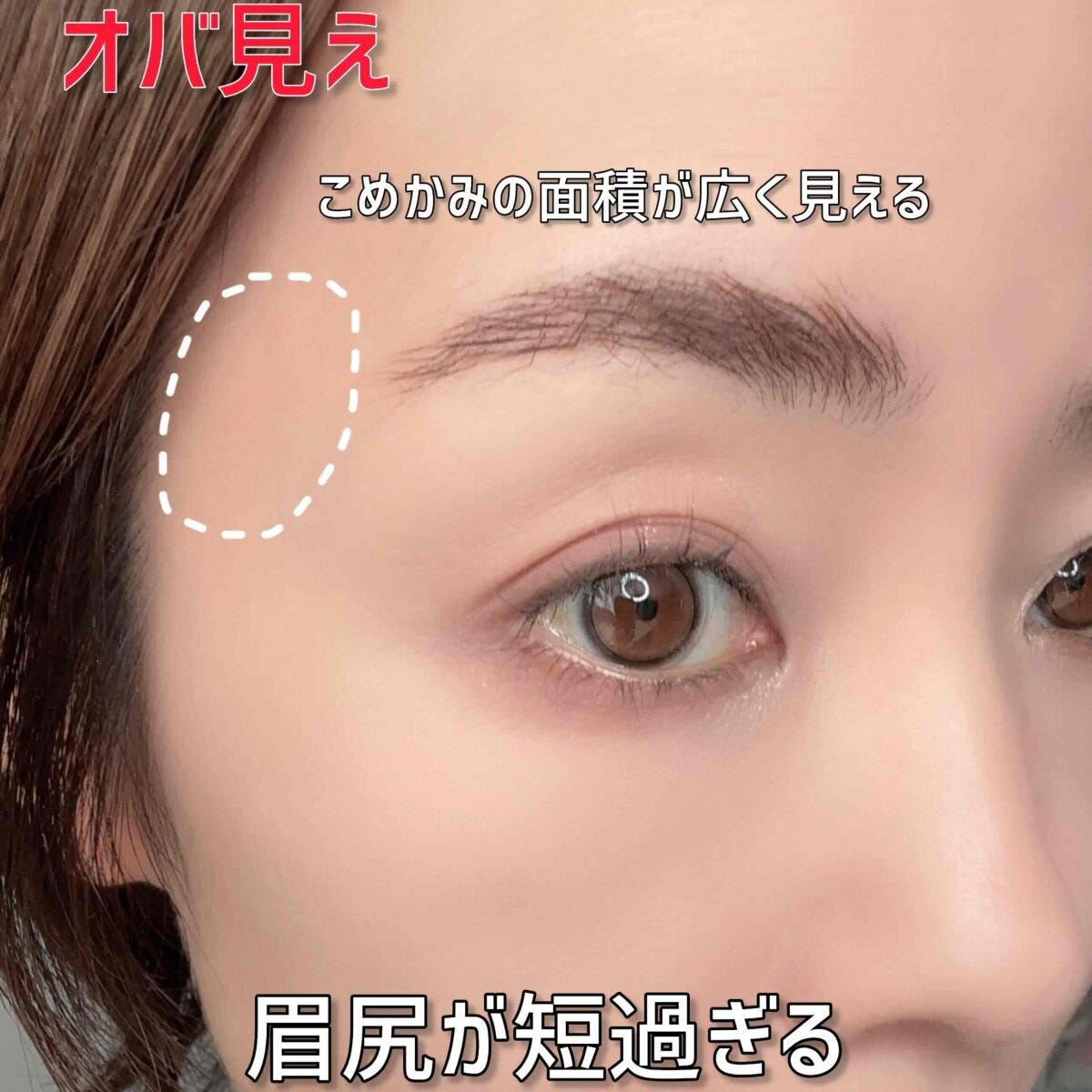 眉尻が短くこめかみが広く見える「オバ見え」の顔アップ