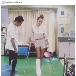 道端アンジェリカの術後リハビリ姿 ギプス 松葉杖すらおしゃれに見える 痛々しい傷口も公開 モデルプレス 道端アンジェリカの術後リハビリ姿 ギプス 松葉杖すらおしゃれに見える 痛々しい傷口も公開 モデルプレス