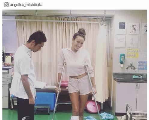 道端アンジェリカの術後リハビリ姿、ギプス&松葉杖すらおしゃれに見える?痛々しい傷口も公開